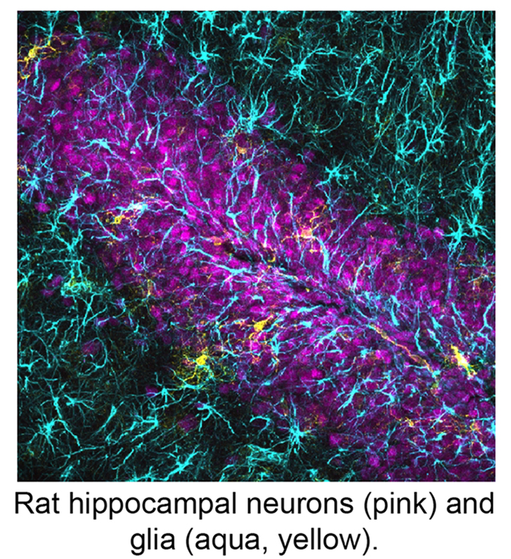 neurons-glia.jpg