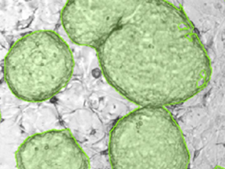 Cloned cells Cloned cells