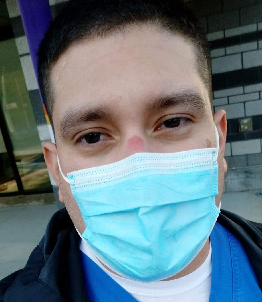 Close up portrait of a dark-haired man wearing a light blue medical face mask. His nose has a red abrasion on his nasal bridge.