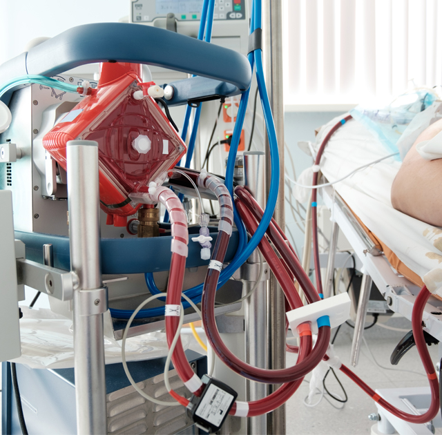 ECMO life support machine being used to treat COVID-19 patients. Study provides some clinical guidance on its efficacy.