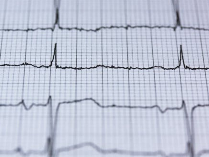 heart monitor heart monitor
