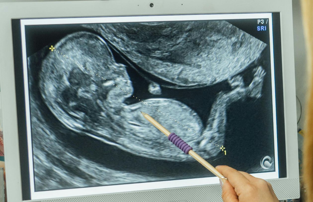 小児心疾患に対する画期的な胎児治療法を開発(UH Cardiac Researcher Develops Breakthrough Advancement in Battling Pediatric Heart Disease)