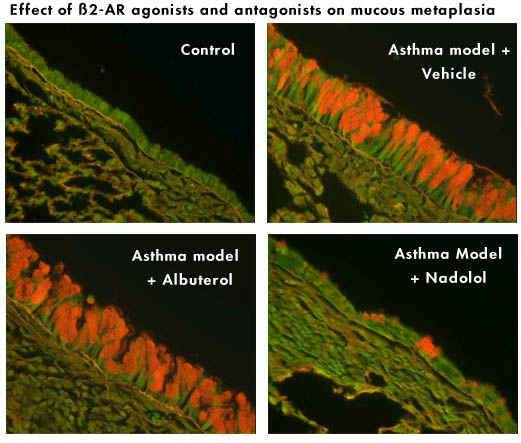 Asthma Models