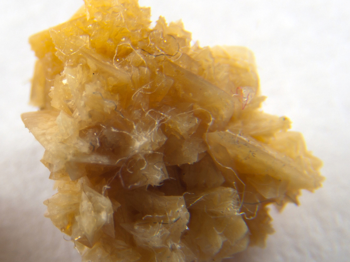 Researchers Propose New Treatment to Prevent Kidney Stones