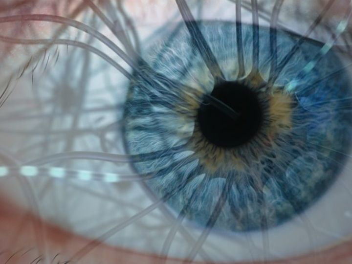 Examining brain through retina Examining brain through retina
