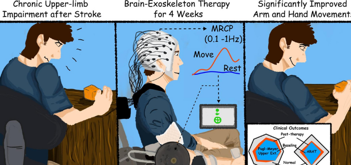 stroke trial stroke trial