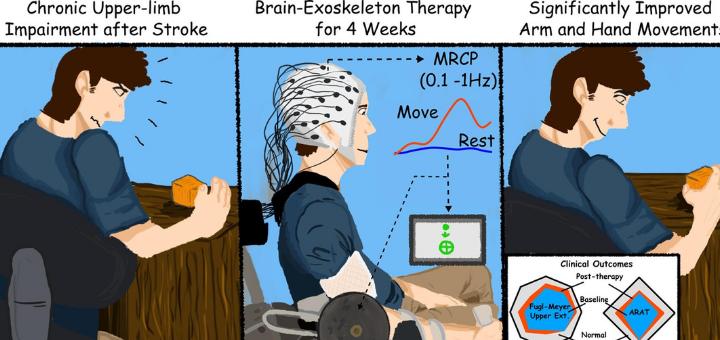 stroke trial 