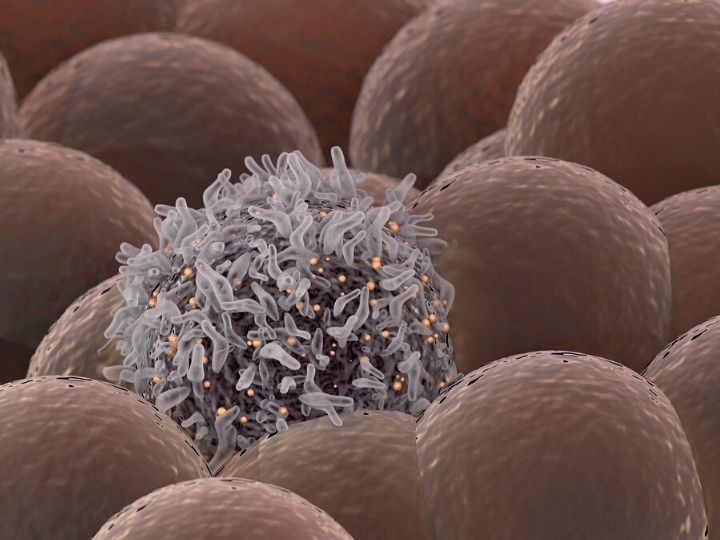 Getty image of cancer cell among healthy cells
