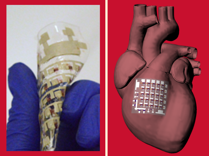 Yu cardiac patch Yu cardiac patch