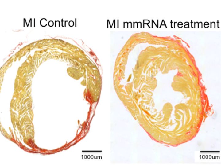 heart repair image