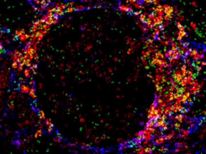 Photo of kidney glomeruli