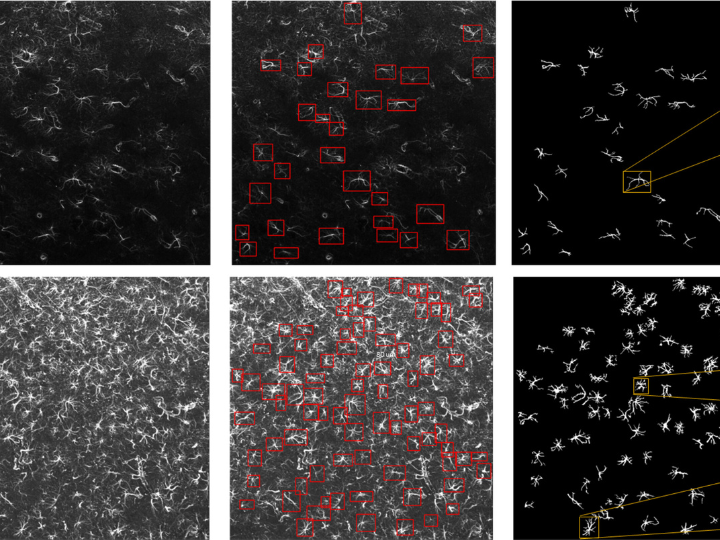 images of astrocytes in the study