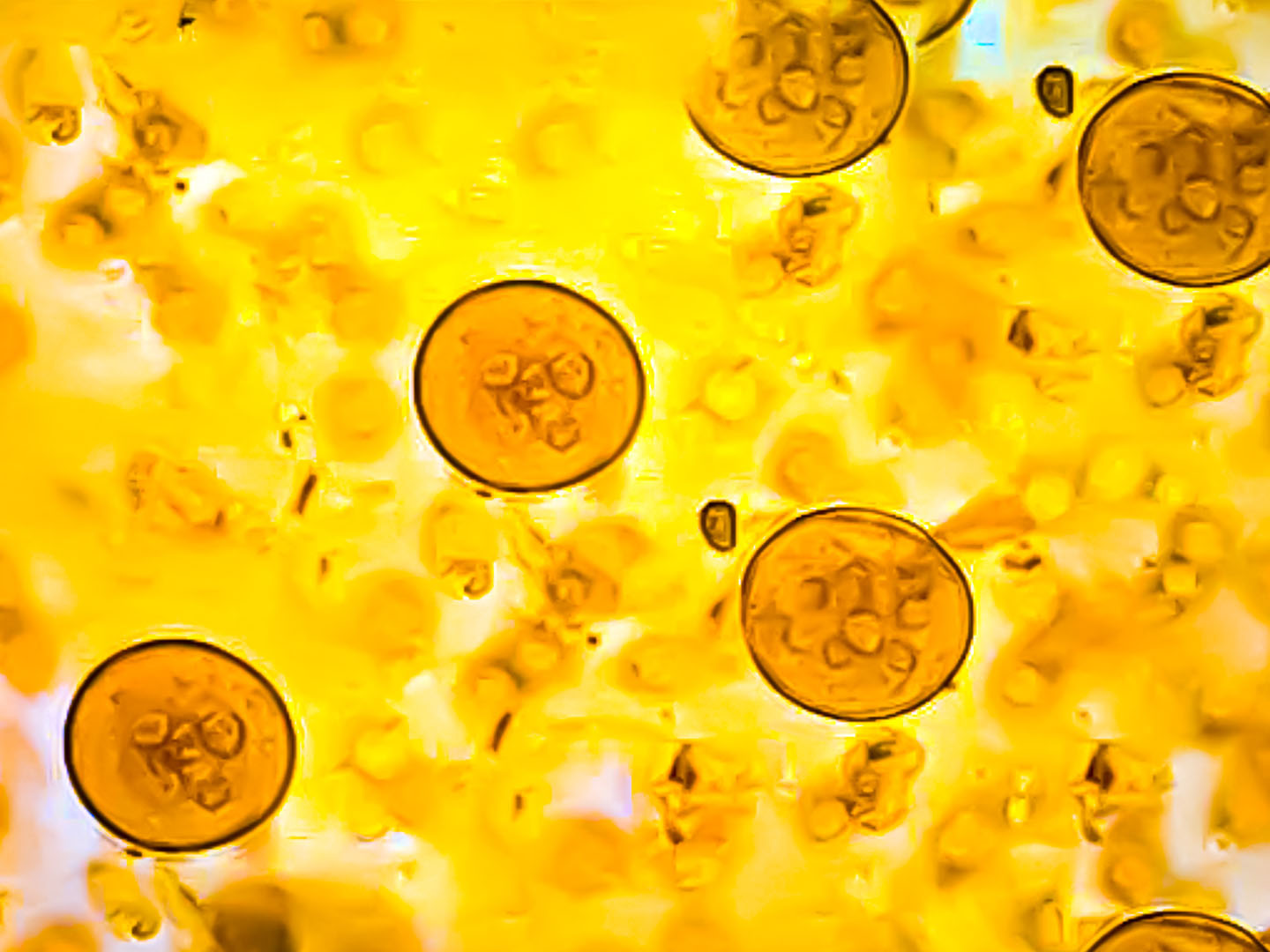 Cryptosporidium parasites