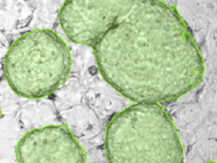 Cloned Stem Cells